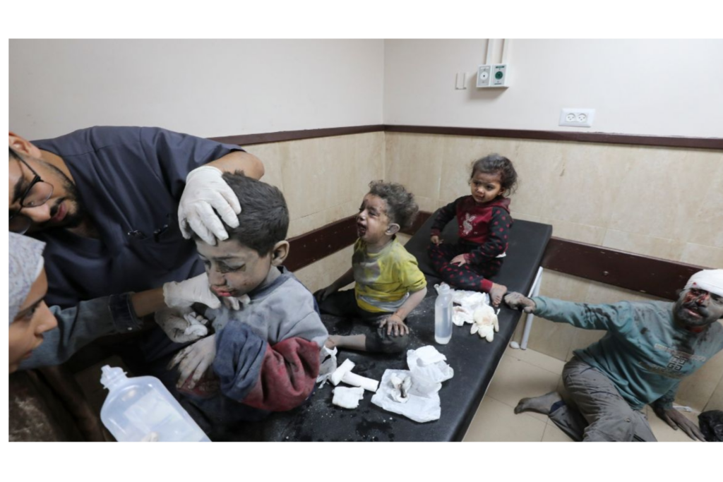 Des médecins témoignent de l’horreur des armes israéliennes : Les bombes à fragmentation tuent et amputent les enfants
