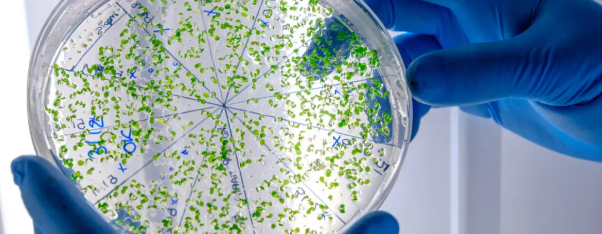 Lutte contre la tuberculose : Des formes extra-pulmonaire se développent au Maroc